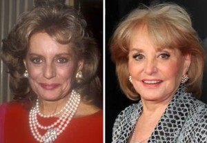 barbara walters plastic surgery before after