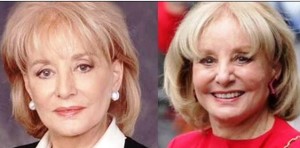barbara walters plastic surgery before and after