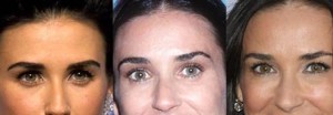 demi moore botox pictures