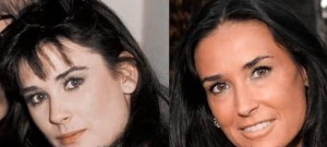 demi moore plastic surgery before after