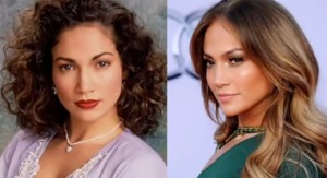 jennifer lopez plastic surgery before and after