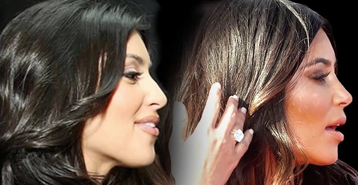 kim-kardashian-nose-job-before-and-after