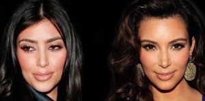 kim kardashian plastic surgery face