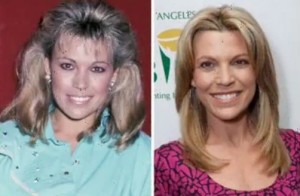 vanna white plastic surgery before and after