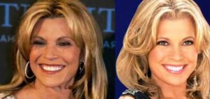 vanna white plastic surgery photos before after