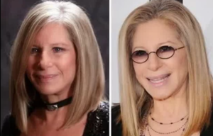 barbra streisand plastic surgery before after