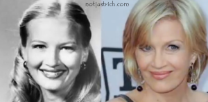 diane sawyer plastic surgery before after