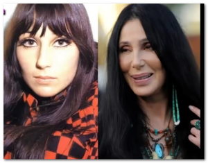 cher plastic surgery before after pictures