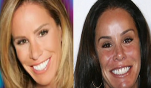 melissa rivers plastic surgery picture before after