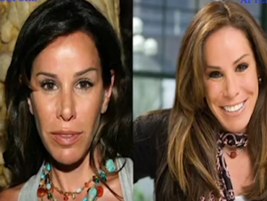 melissa rivers surgery plastic surgery photo before after