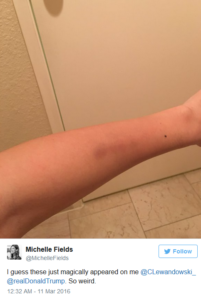 michelle fields hands assault picture